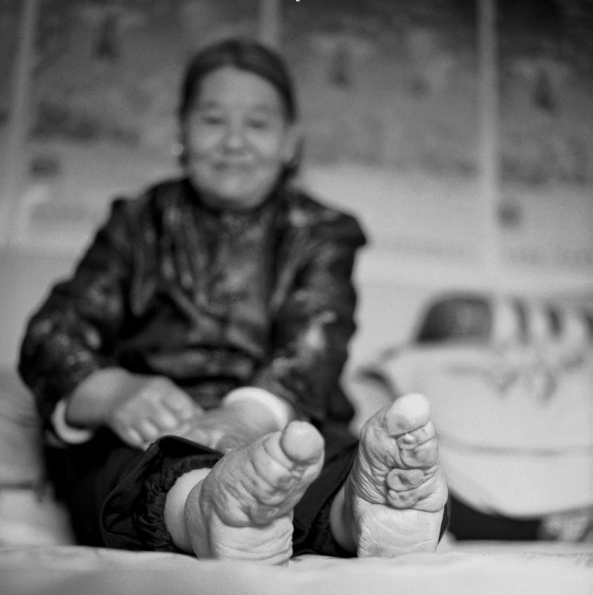 Chinese women with bound feet