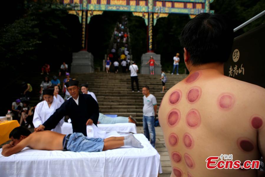 Free cupping therapy at Taoist mountain