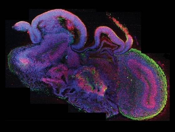 科學家利用干細胞培育人腦 達9周胎兒水平