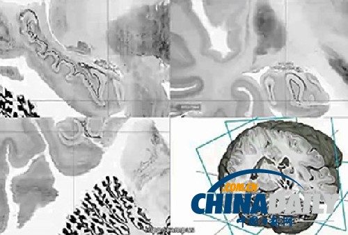 科學家繪制出3D人腦高清模型 或可助治神經疾病